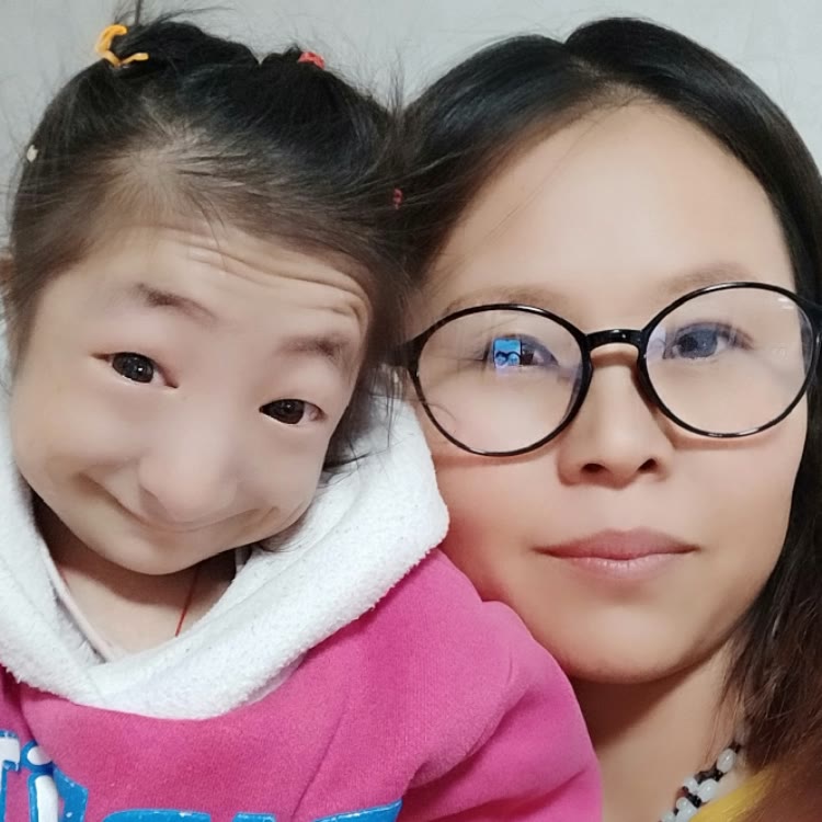 大庆拇指姑娘刘爽